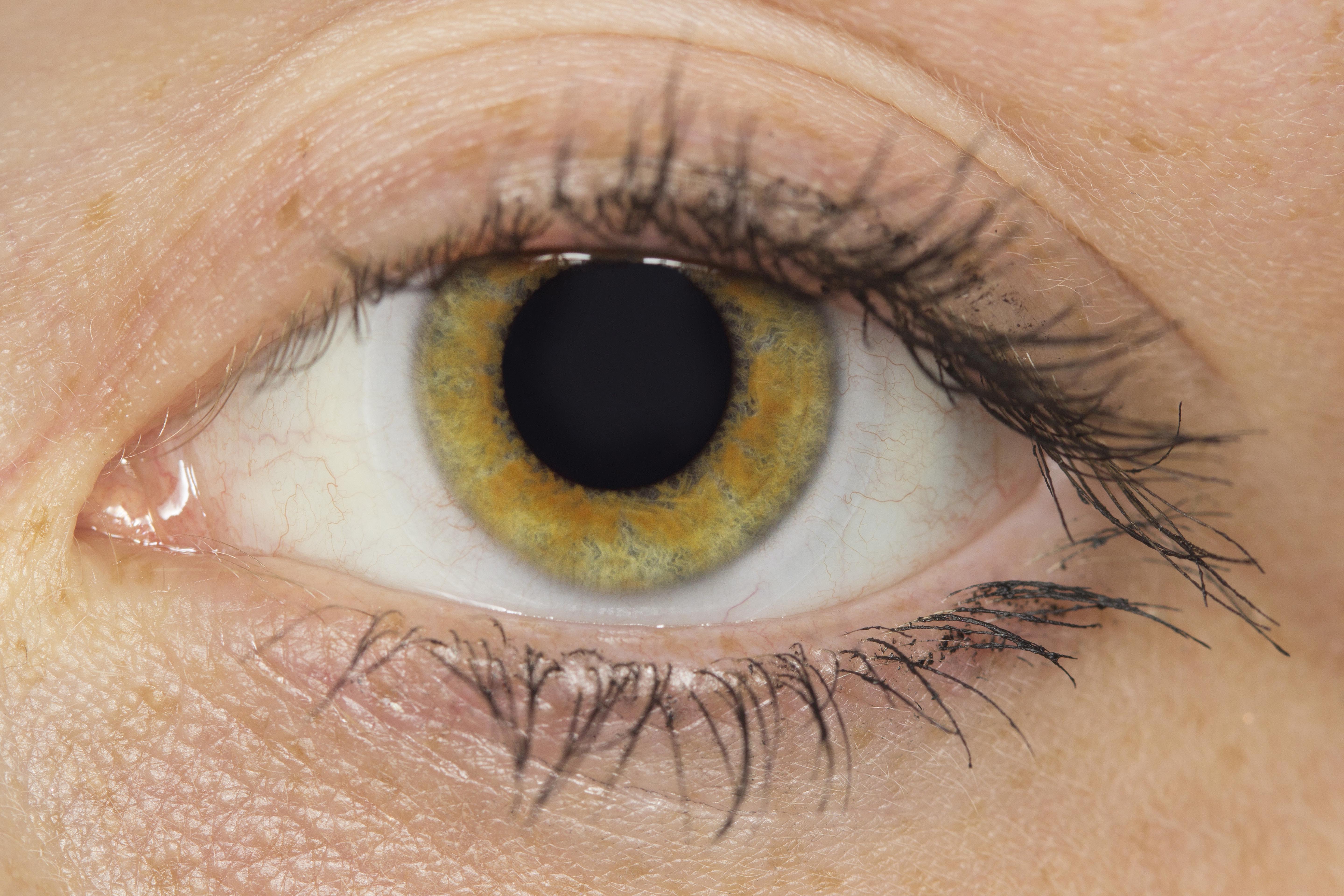 Eye 1