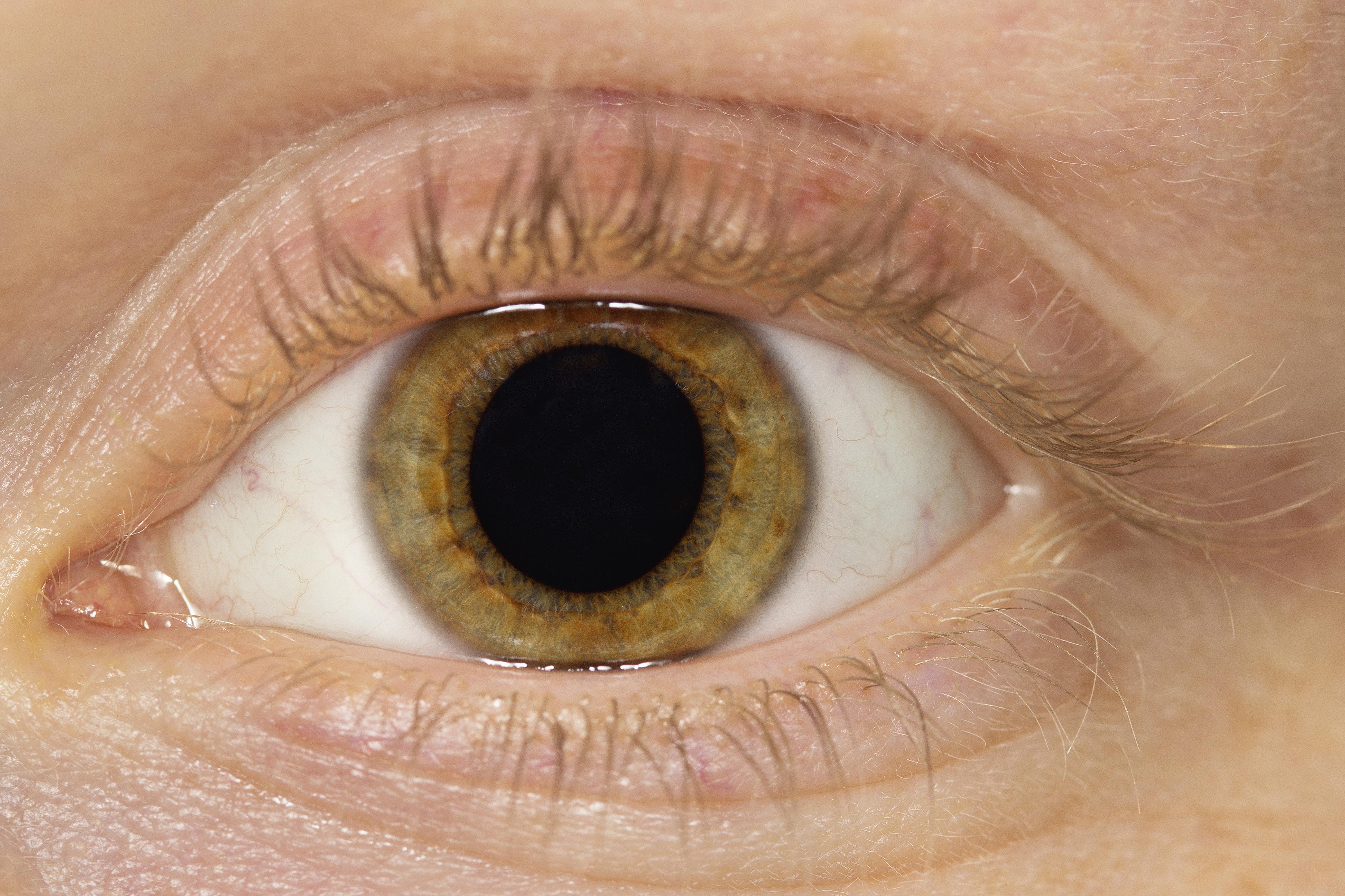 Eye 3