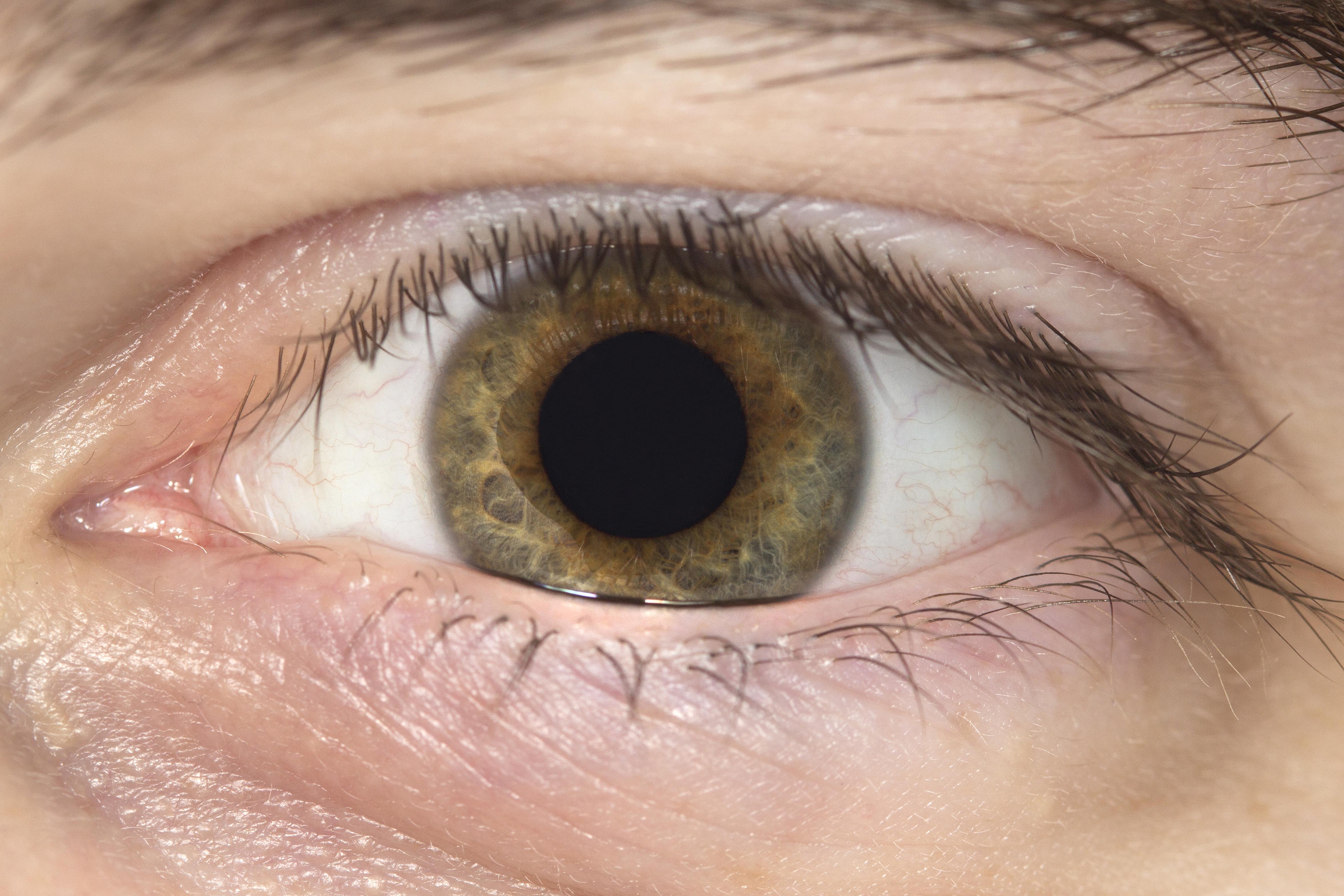 Eye 4