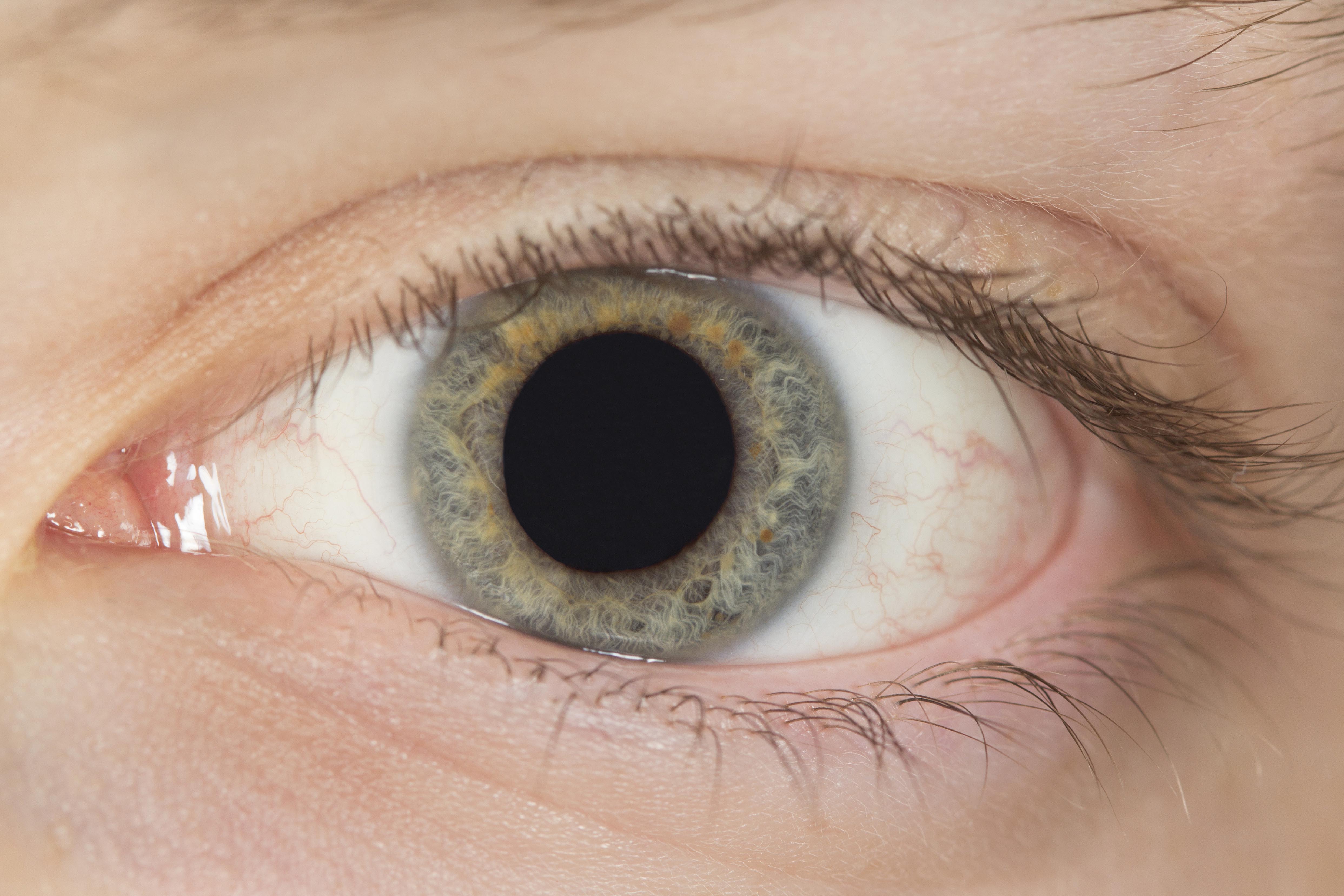 Eye 5