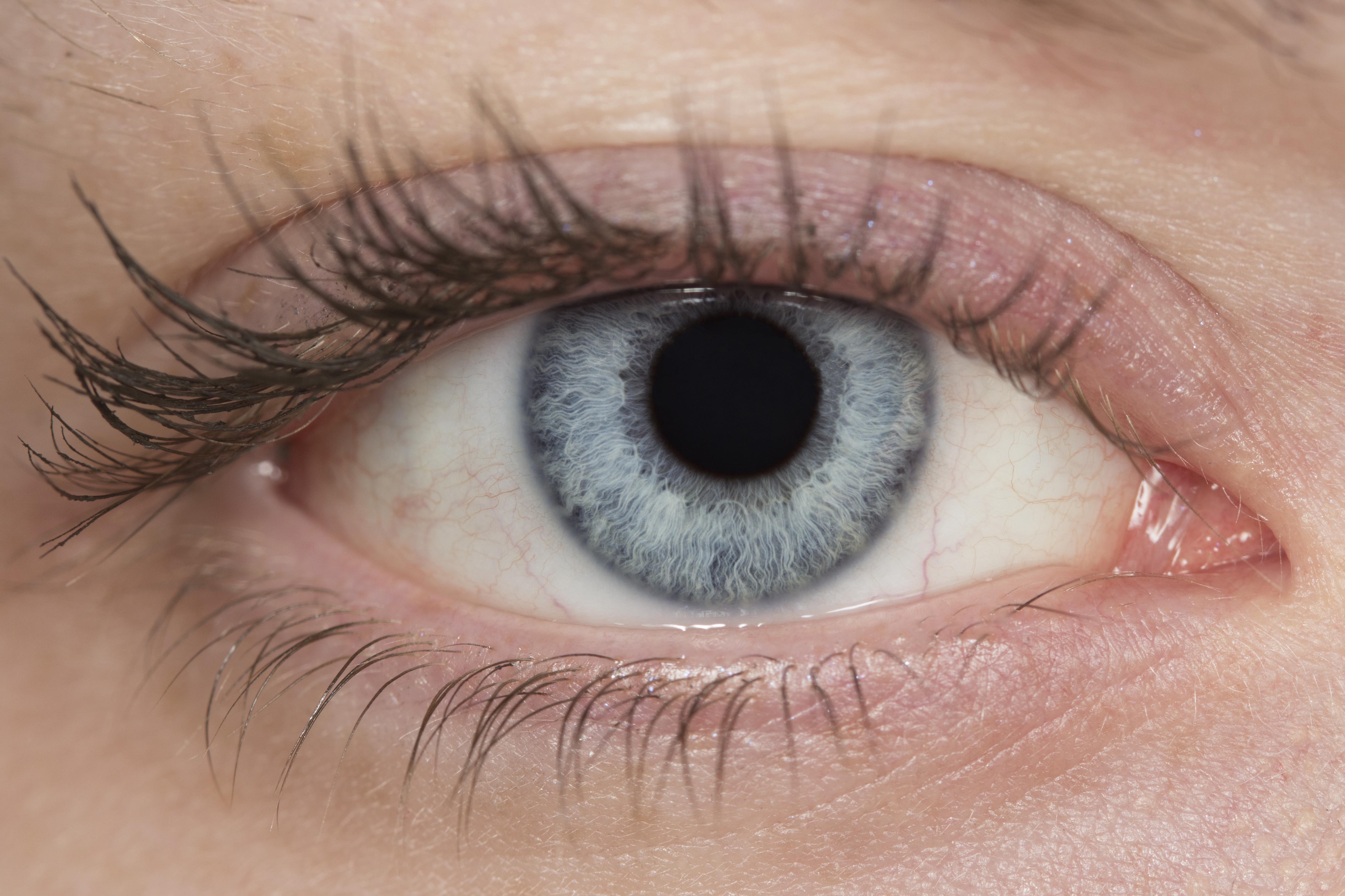 Eye 6