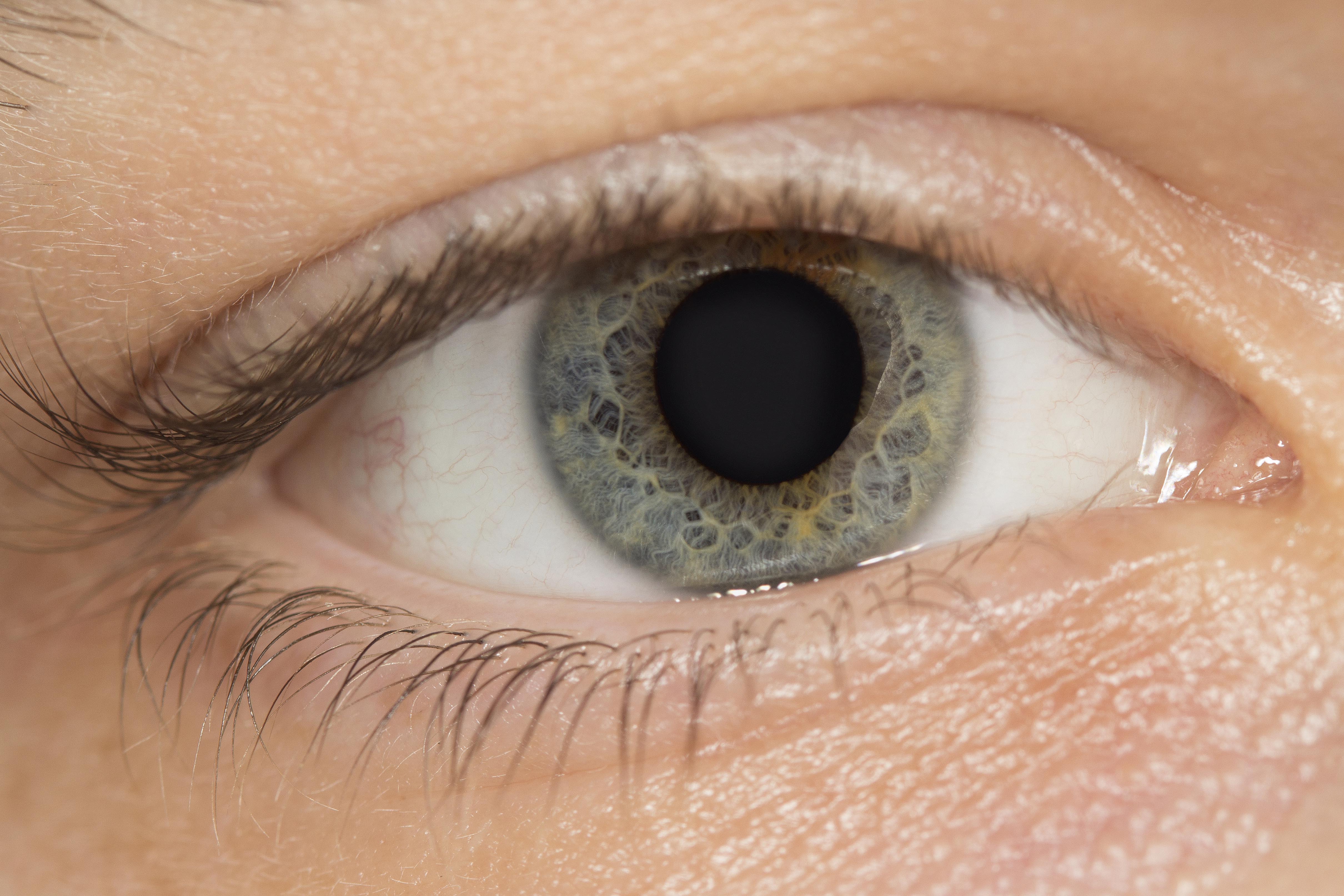 Eye 7