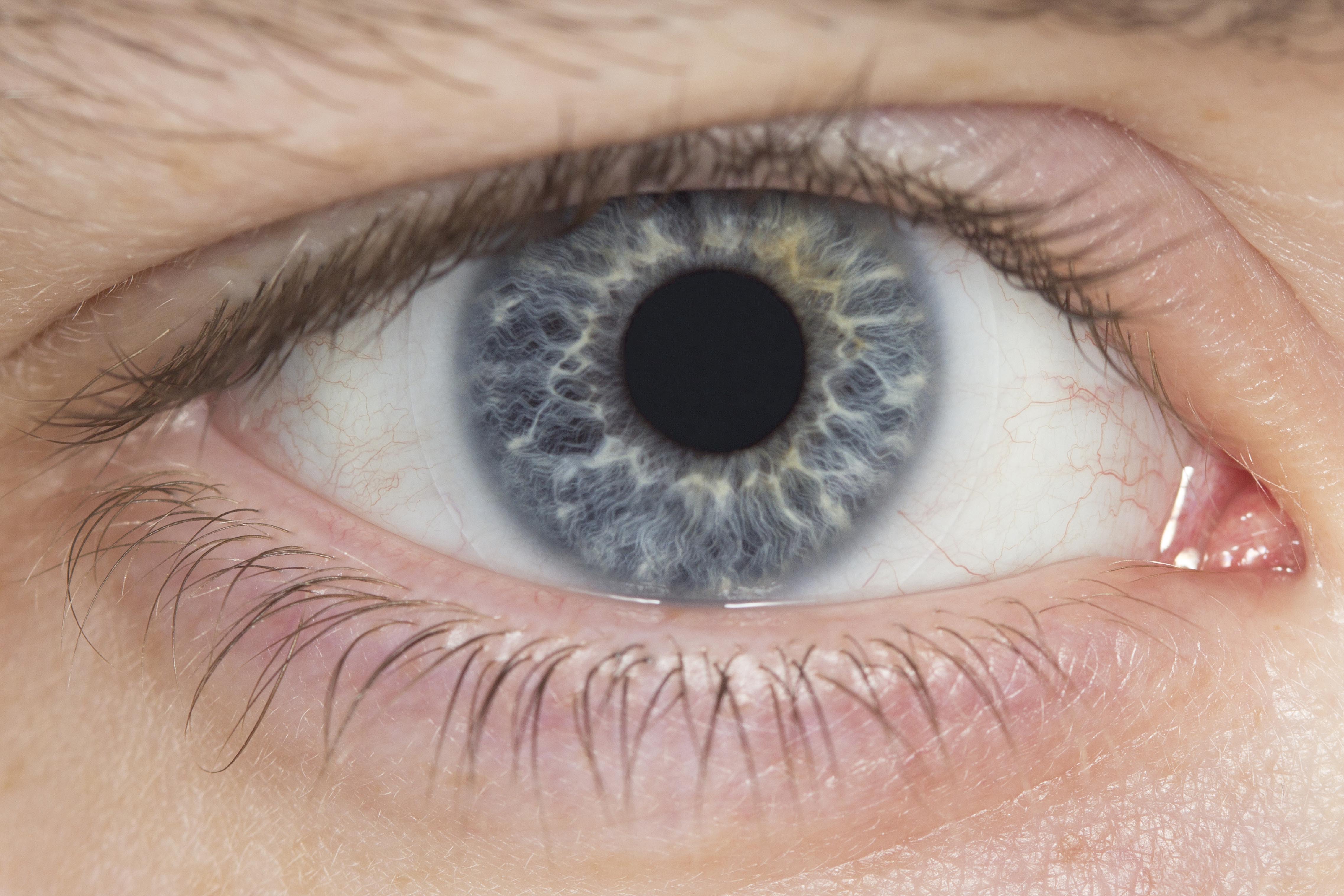 Eye 8